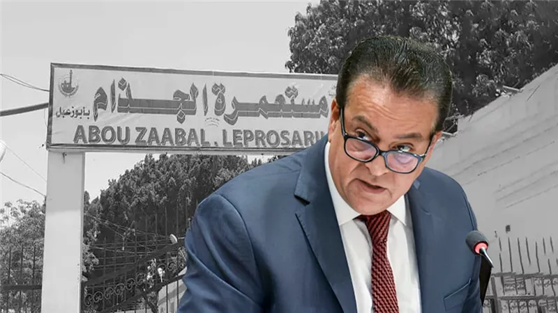 أول توضيح من الصحة بشأن غلق مستعمرة الجذام واستثمار أرضها